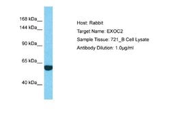 EXOC2 Antibody, Novus Biologicals 100 &mu;L | Buy Online | Novus Biologicals | Fisher Scientific